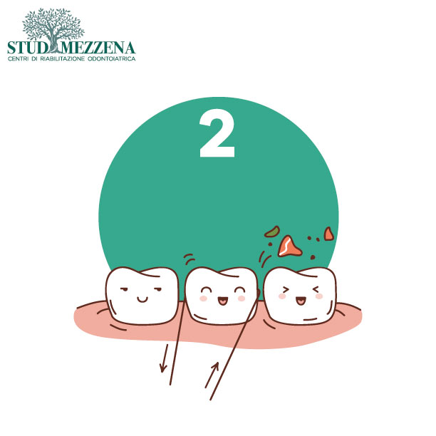 Terapia causale | Studi Mezzena | Dentista a Brescia