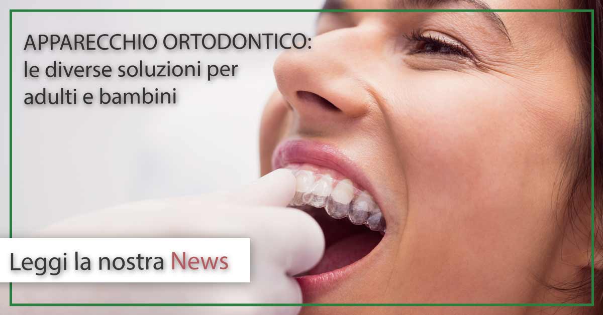Apparecchio ortodontico | Studi Mezzena | Dentista a Brescia