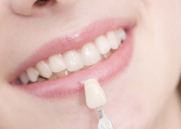 Estetica-Dentale-cavellini